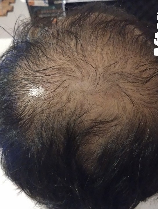 アフター（事例01）