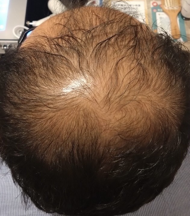 ビフォー（事例01）