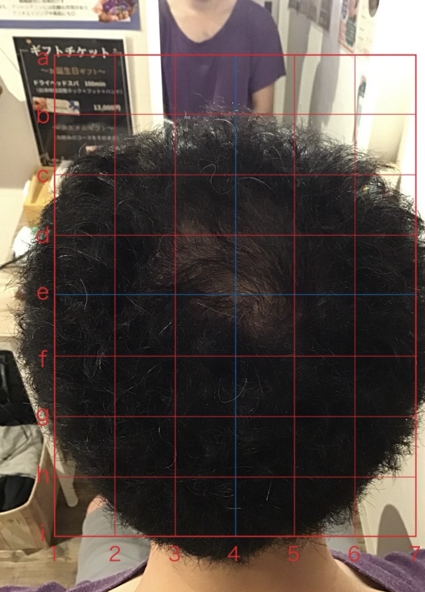 アフター（事例02）