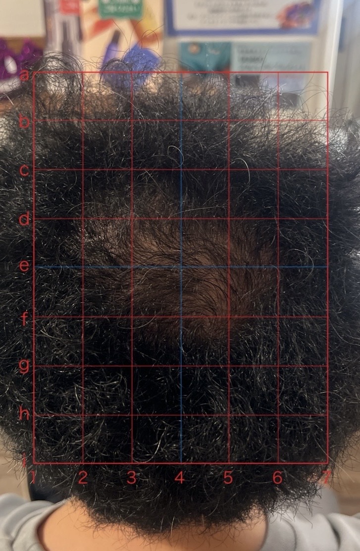 ビフォー（事例02）